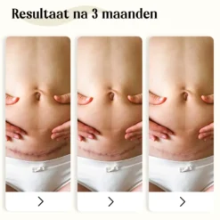 Dermatix Siliconen Gel (15 gr)