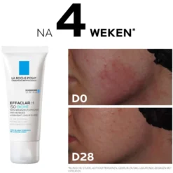 La Roche-Posay Effaclar H Iso-biome Ultra Soothing Care (40 ml)