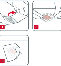 Leukoplast Cuticell Classic 5 x 5 cm (5 stuks)
