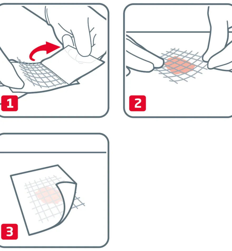 Leukoplast Cuticell Classic 5 x 5 cm (5 stuks)