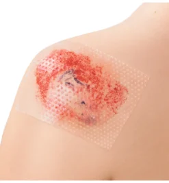 Leukoplast Cuticell Contact 5 x 7,5 cm (5 stuks)