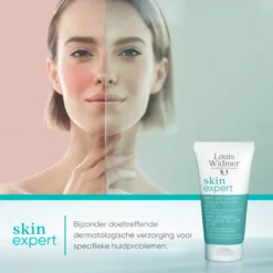 Louis Widmer Skinexpert Carbamide Forte 18 % Ureum Voetencrème tegen Eelt zonder Parfum (50 ml)