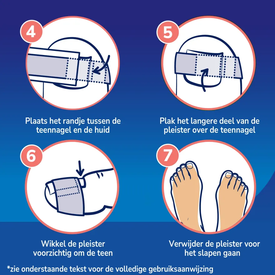 Scholl Ingegroeide Teennagel pijnverlichtende strips (10 stuks)