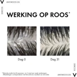 Vichy Dercos Anti-dandruff Shampoo Itchy Scalp (390 ml)