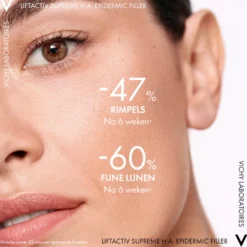Vichy Liftactiv Supreme Serum H.a. Epidermic Filler (30 ml)